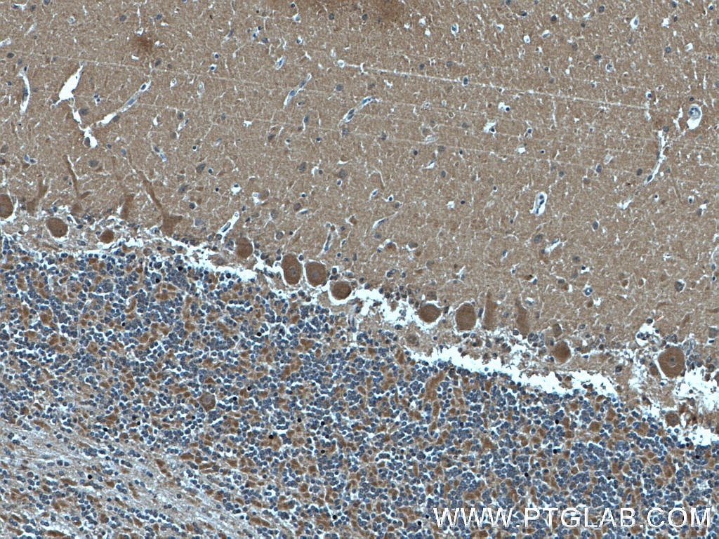 Immunohistochemistry (IHC) staining of human cerebellum tissue using CDR2L Monoclonal antibody (66791-1-Ig)