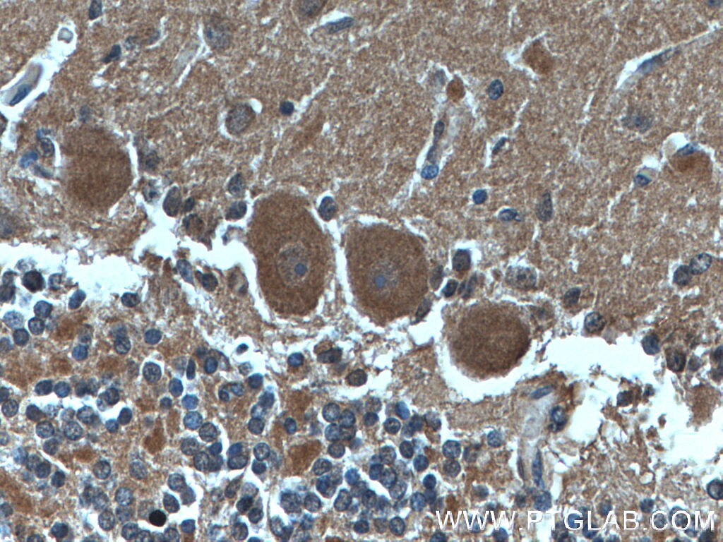Immunohistochemistry (IHC) staining of human cerebellum tissue using CDR2L Monoclonal antibody (66791-1-Ig)