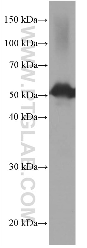 Western Blot (WB) analysis of human brain tissue using CDR2L Monoclonal antibody (66791-1-Ig)