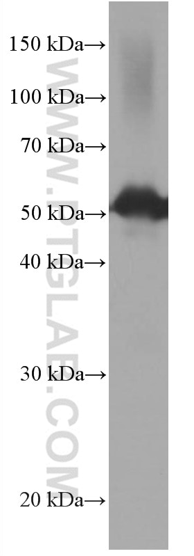 WB analysis of human brain using 66791-1-Ig