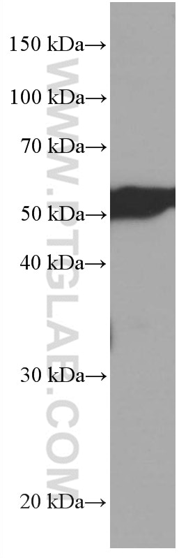 Western Blot (WB) analysis of rat brain tissue using CDR2L Monoclonal antibody (66791-1-Ig)