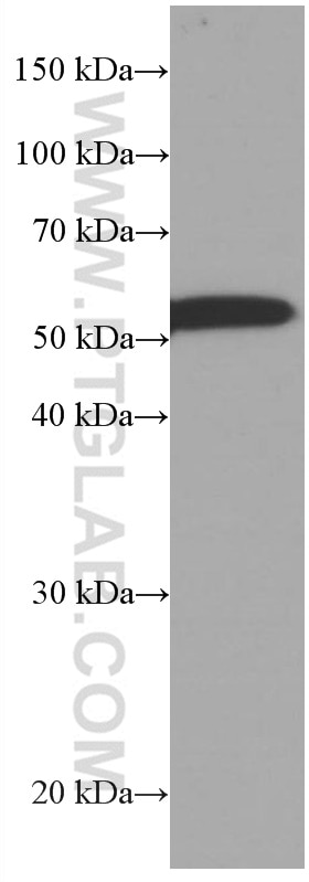 Western Blot (WB) analysis of mouse brain tissue using CDR2L Monoclonal antibody (66791-1-Ig)