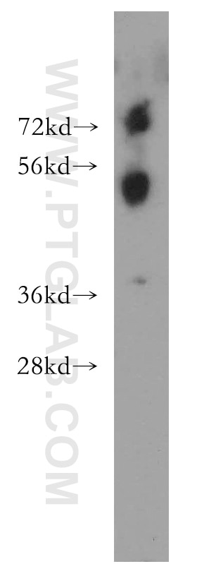 Western Blot (WB) analysis of human heart tissue using CDS2 Polyclonal antibody (13175-1-AP)