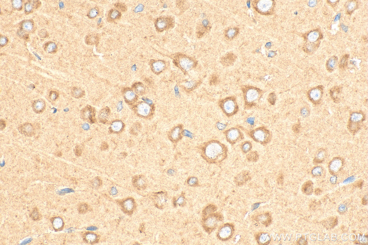Immunohistochemistry (IHC) staining of rat brain tissue using CDS2 Polyclonal antibody (28407-1-AP)