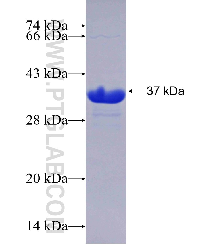 CDS2 fusion protein Ag29228 SDS-PAGE