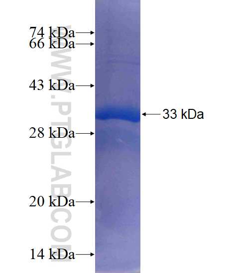 CDS2 fusion protein Ag3842 SDS-PAGE