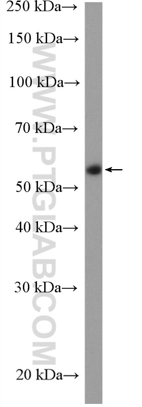 Western Blot (WB) analysis of A431 cells using CDSN Polyclonal antibody (13184-1-AP)