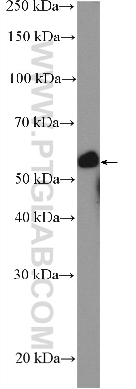 Western Blot (WB) analysis of A431 cells using CDSN Polyclonal antibody (13184-1-AP)