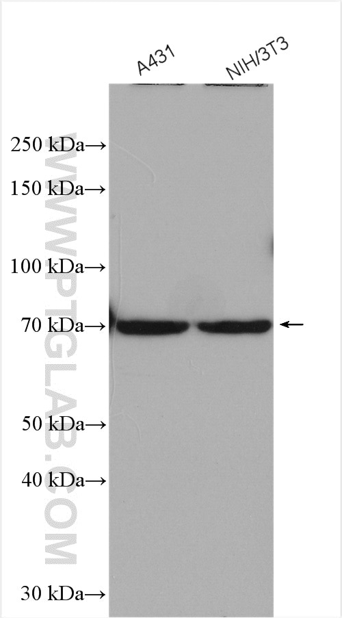 Western Blot (WB) analysis of various lysates using CDSN Polyclonal antibody (13184-1-AP)