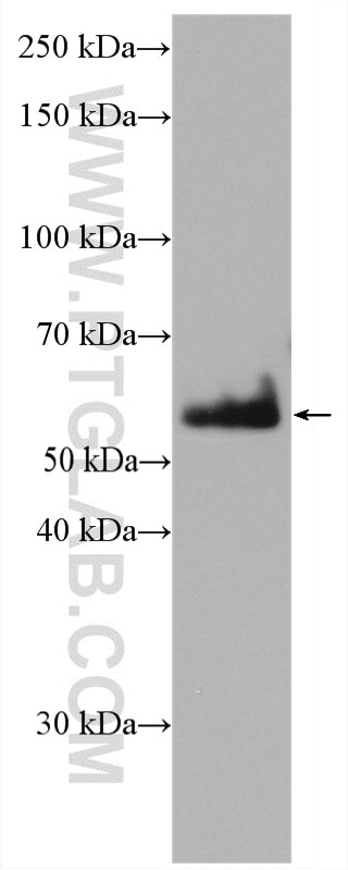 Western Blot (WB) analysis of mouse skin tissue using CDSN Polyclonal antibody (27953-1-AP)