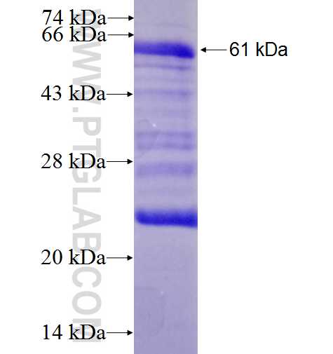 CDSN fusion protein Ag3854 SDS-PAGE