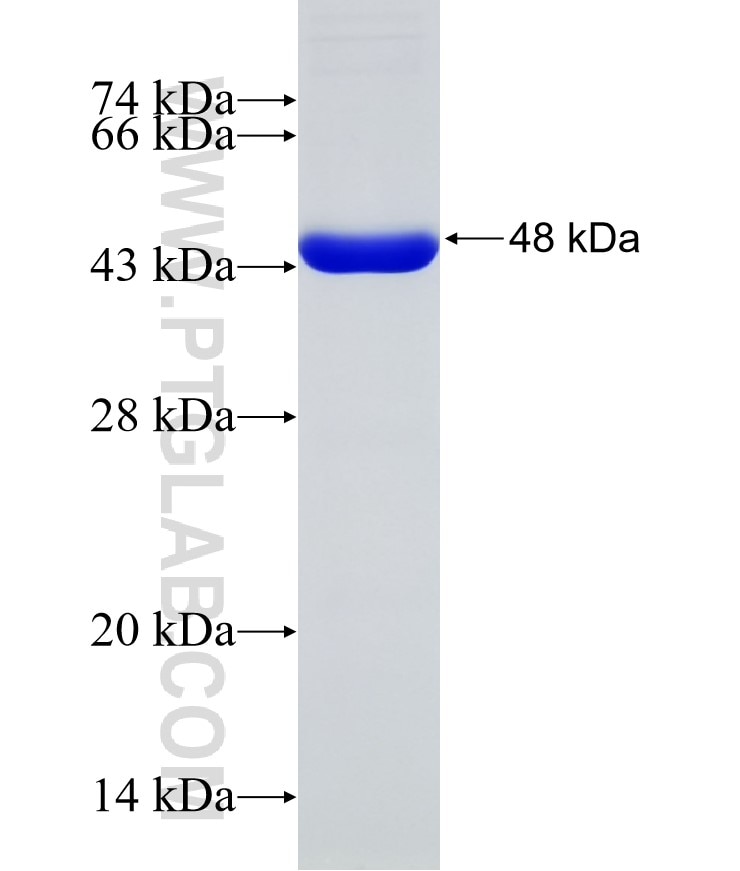 CDT1 fusion protein Ag31758 SDS-PAGE