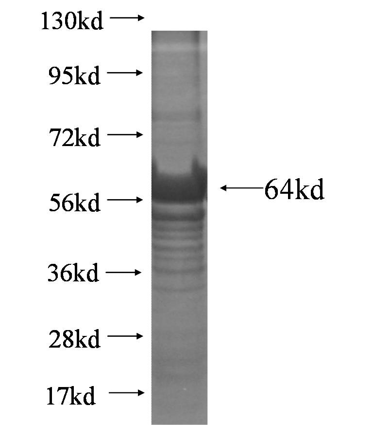 CDT1 fusion protein Ag5810 SDS-PAGE