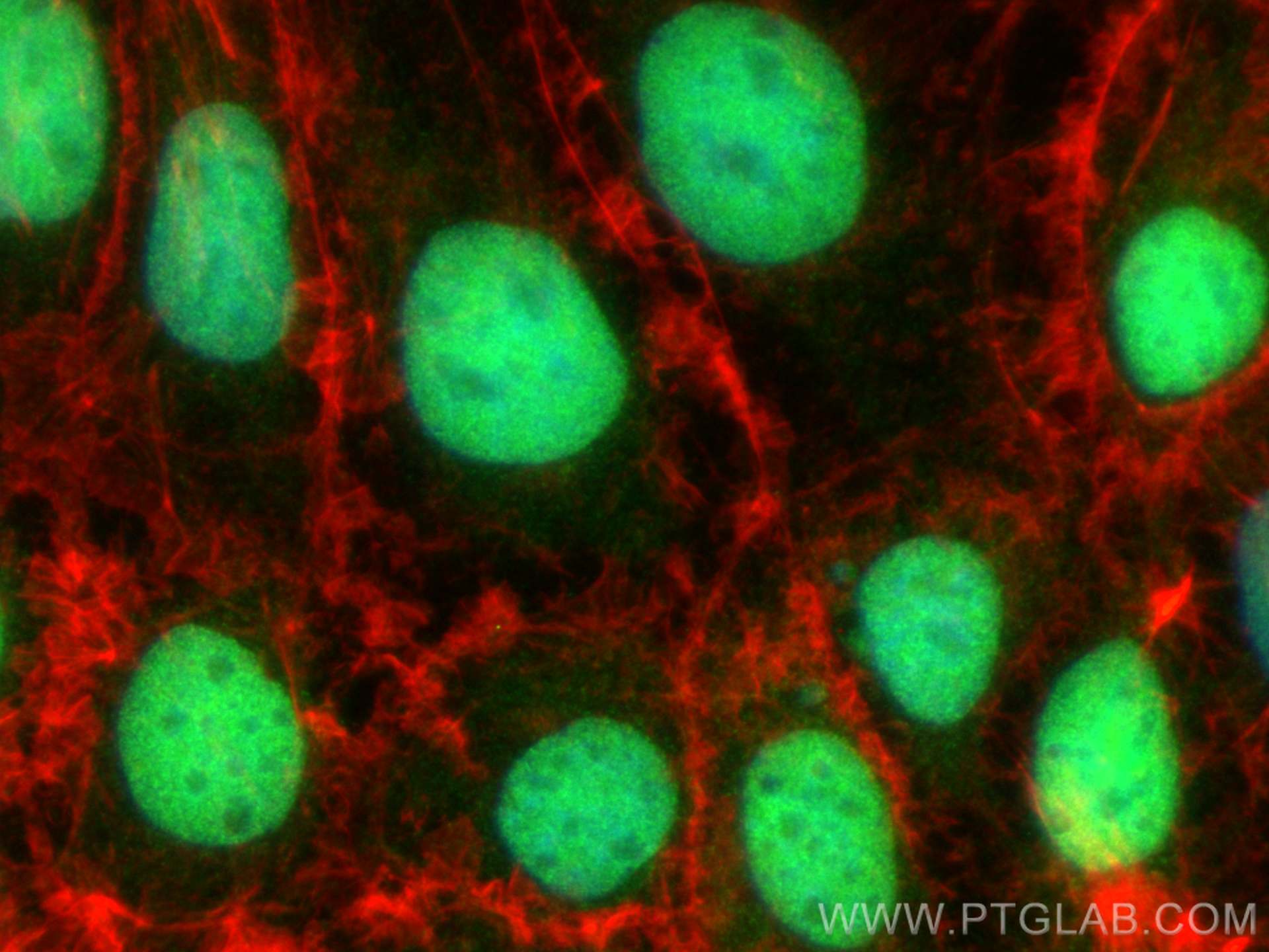 Immunofluorescence (IF) / fluorescent staining of Caco-2 cells using human CDX1 Polyclonal antibody (21655-1-AP)