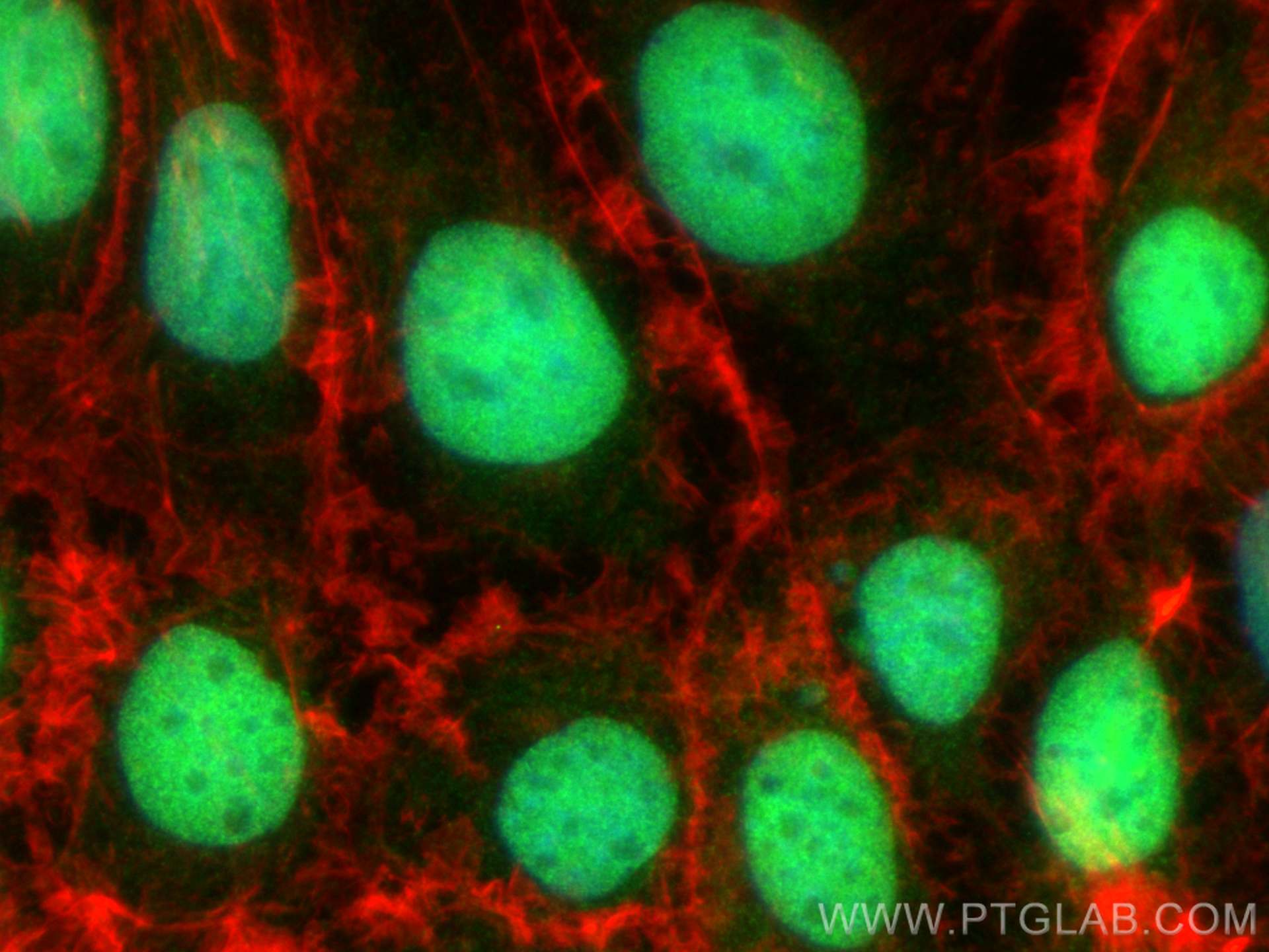 IF Staining of Caco-2 using 21655-1-AP