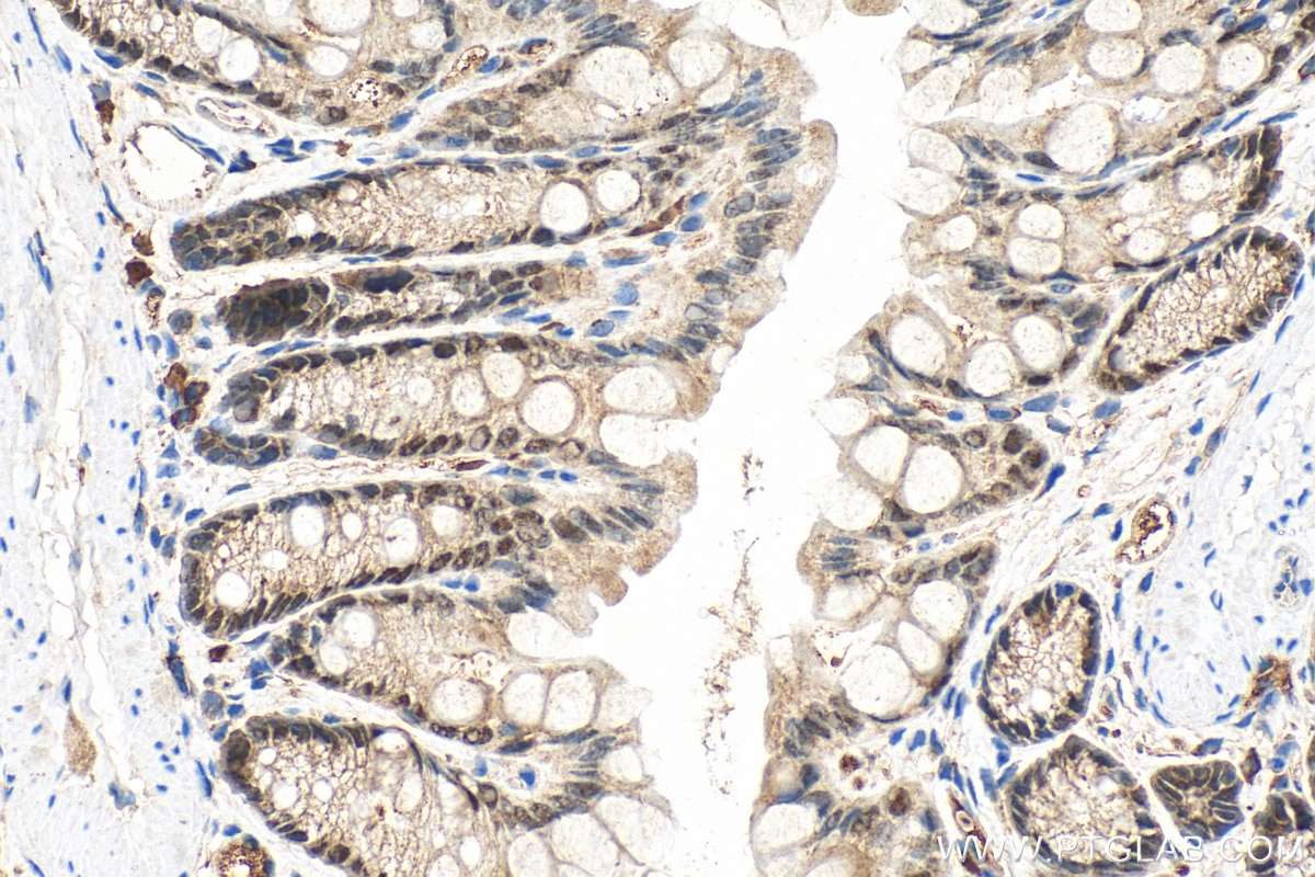 Immunohistochemistry (IHC) staining of mouse colon tissue using CDX1 Polyclonal antibody (21655-1-AP)