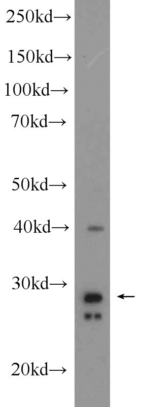 Western Blot (WB) analysis of mouse stomach tissue using CDX1 Polyclonal antibody (21655-1-AP)