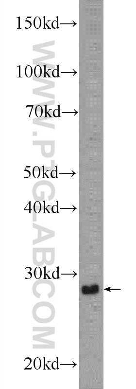 Western Blot (WB) analysis of mouse small intestine tissue using CDX1 Polyclonal antibody (21655-1-AP)