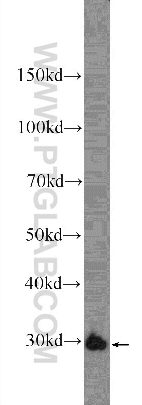 WB analysis of mouse colon using 21655-1-AP