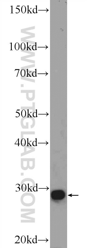 Western Blot (WB) analysis of mouse small intestine tissue using CDX1 Polyclonal antibody (21655-1-AP)