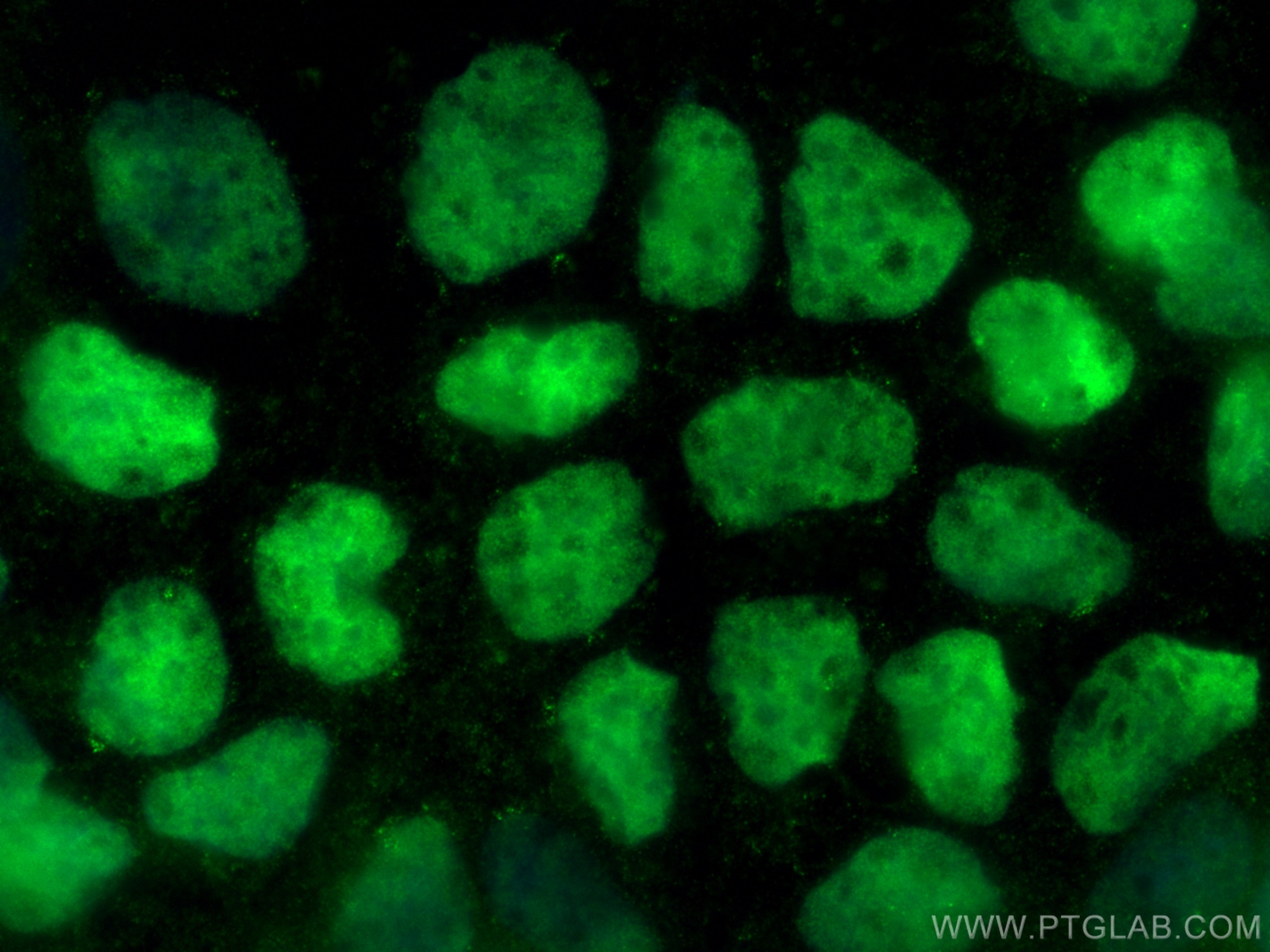 Immunofluorescence (IF) / fluorescent staining of Caco-2 cells using CDX2 Polyclonal antibody (22101-1-AP)