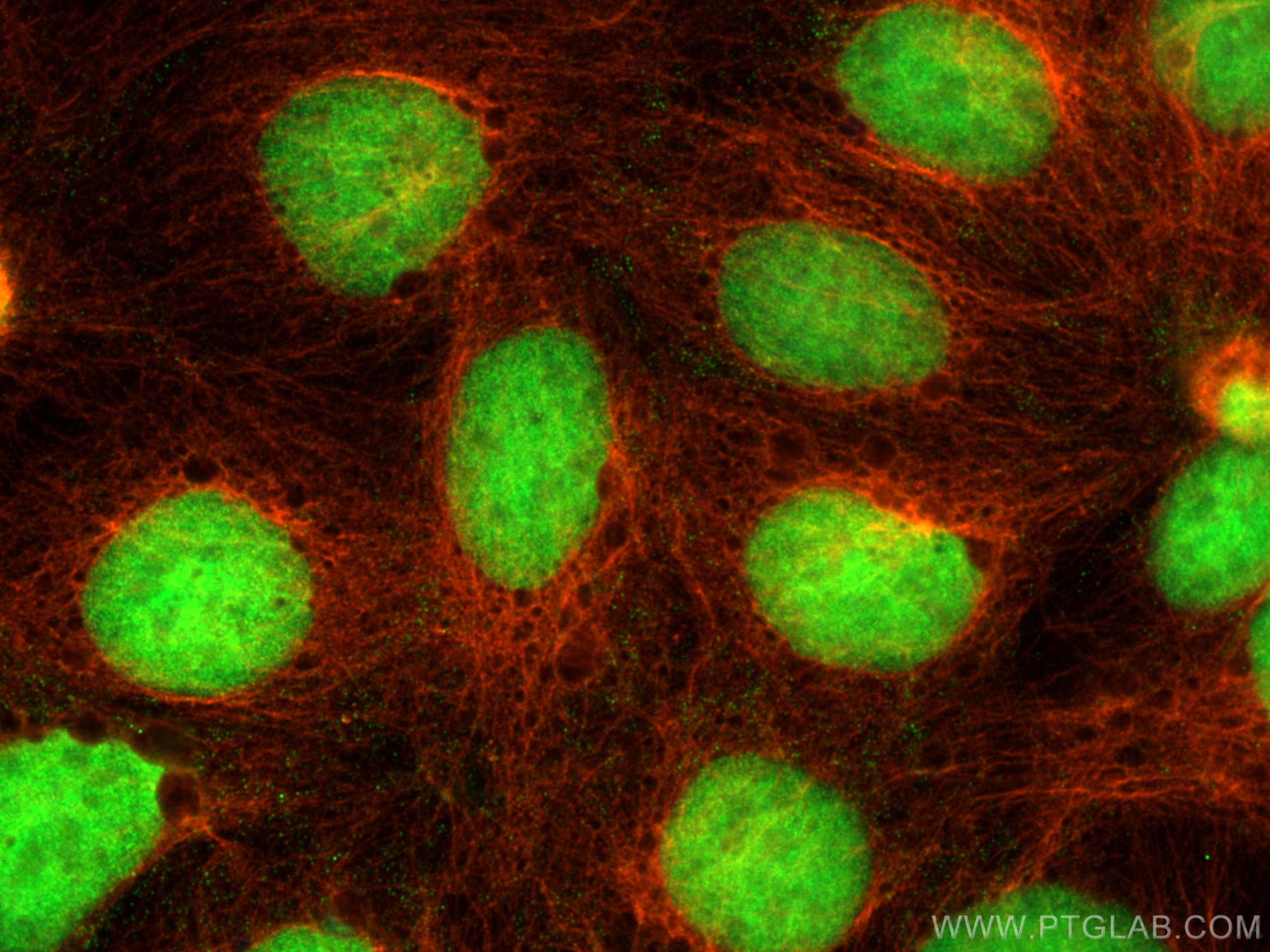 Immunofluorescence (IF) / fluorescent staining of Caco-2 cells using CDX2 Polyclonal antibody (22101-1-AP)