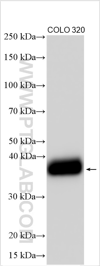Western Blot (WB) analysis of various lysates using CDX2 Polyclonal antibody (22101-1-AP)