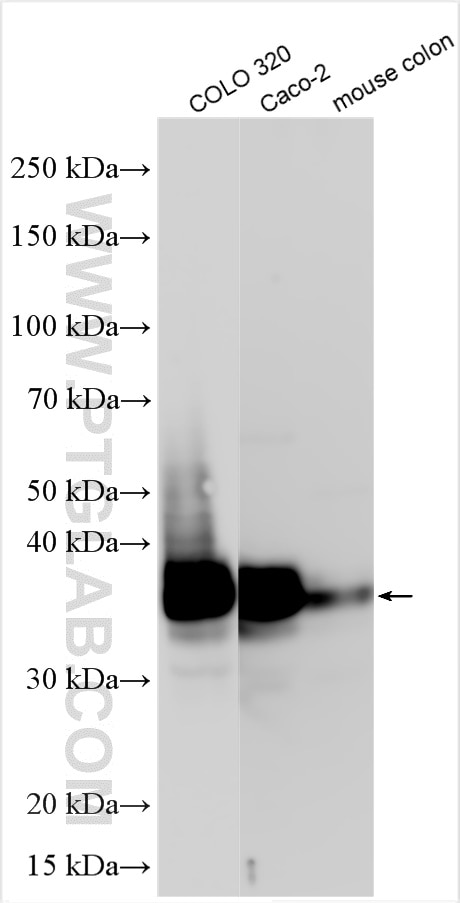 Western Blot (WB) analysis of various lysates using CDX2 Polyclonal antibody (22101-1-AP)
