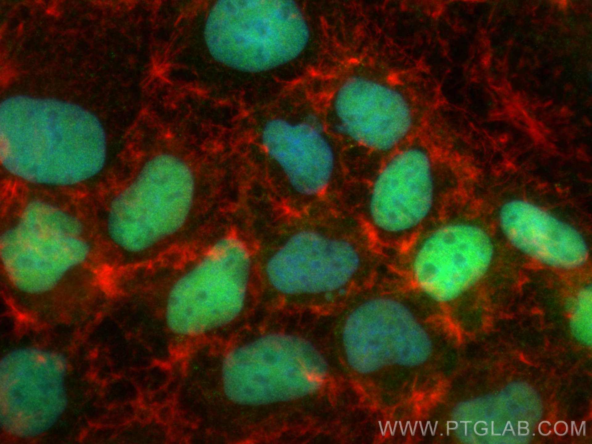 Immunofluorescence (IF) / fluorescent staining of Caco-2 cells using CDX2 Polyclonal antibody (30380-1-AP)