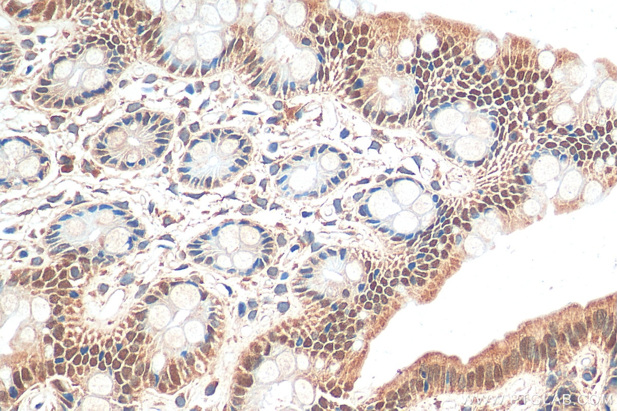 Immunohistochemistry (IHC) staining of rat colon tissue using CDX2 Polyclonal antibody (30380-1-AP)