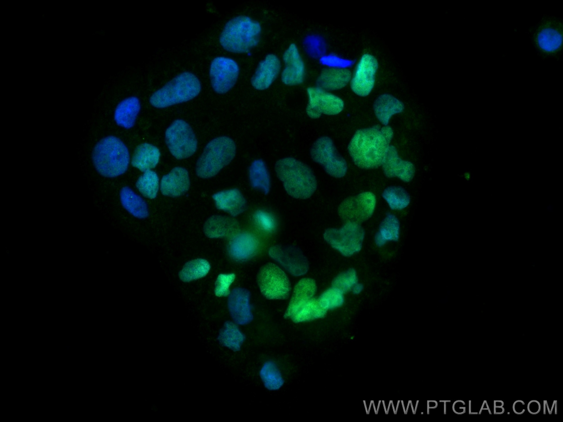 Immunofluorescence (IF) / fluorescent staining of Caco-2 cells using CDX2 Monoclonal antibody (60243-1-Ig)