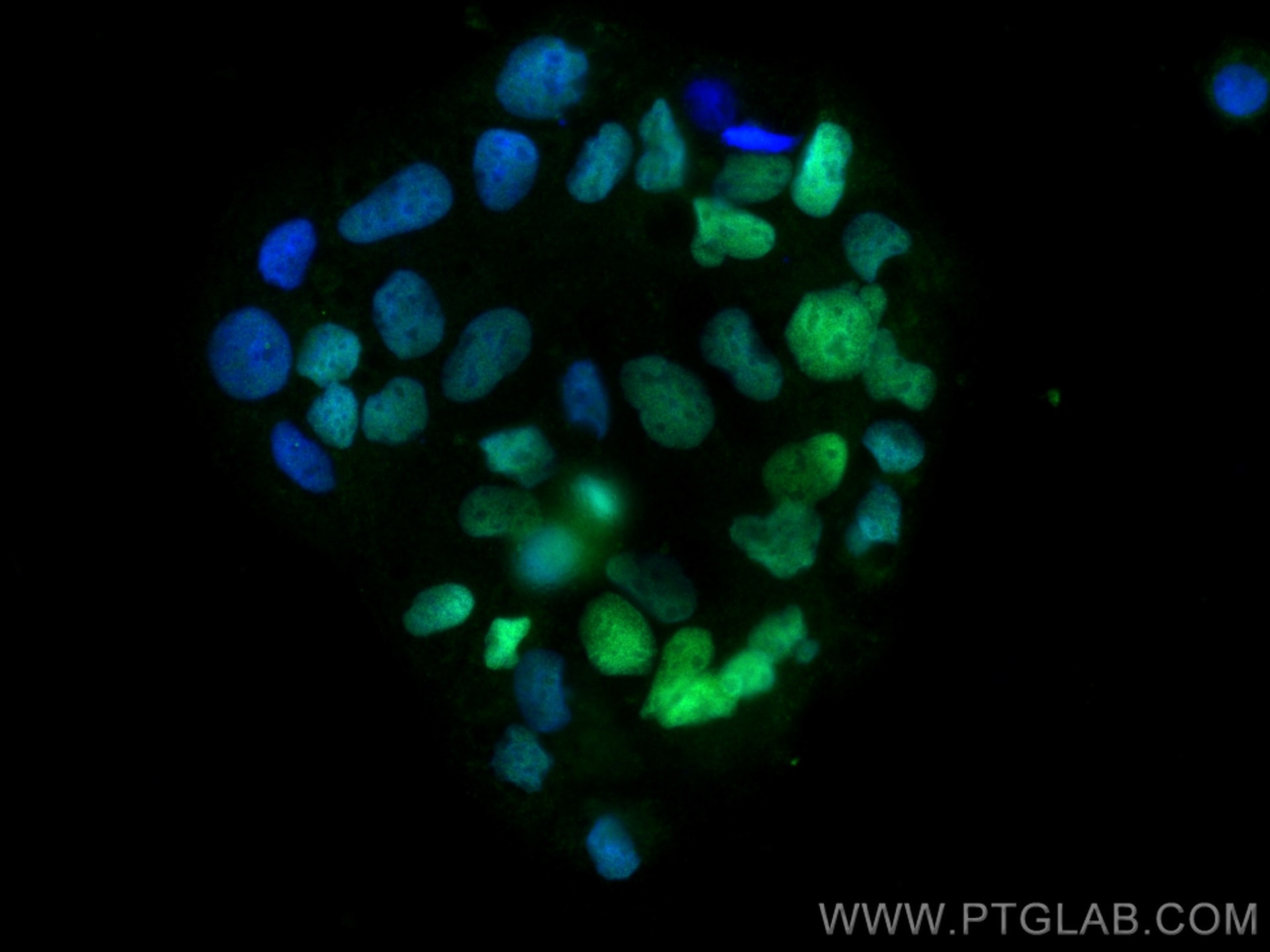 IF Staining of Caco-2 using 60243-1-Ig