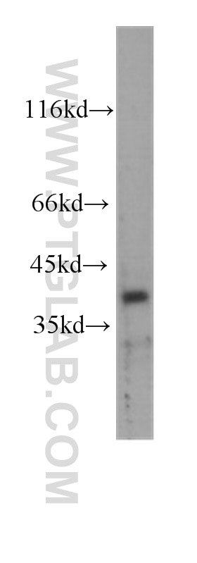 CDX2 Monoclonal antibody