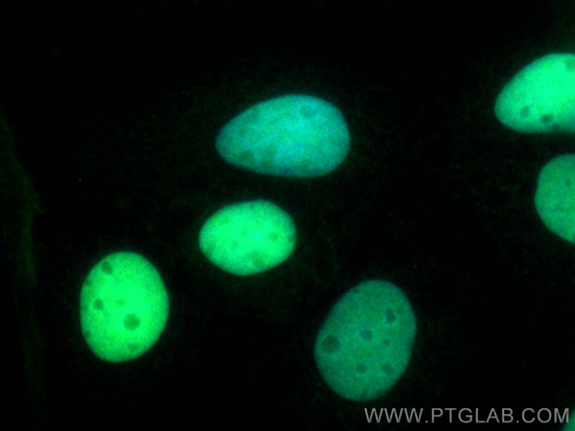 Immunofluorescence (IF) / fluorescent staining of Caco-2 cells using CDX2 Recombinant antibody (82659-1-RR)