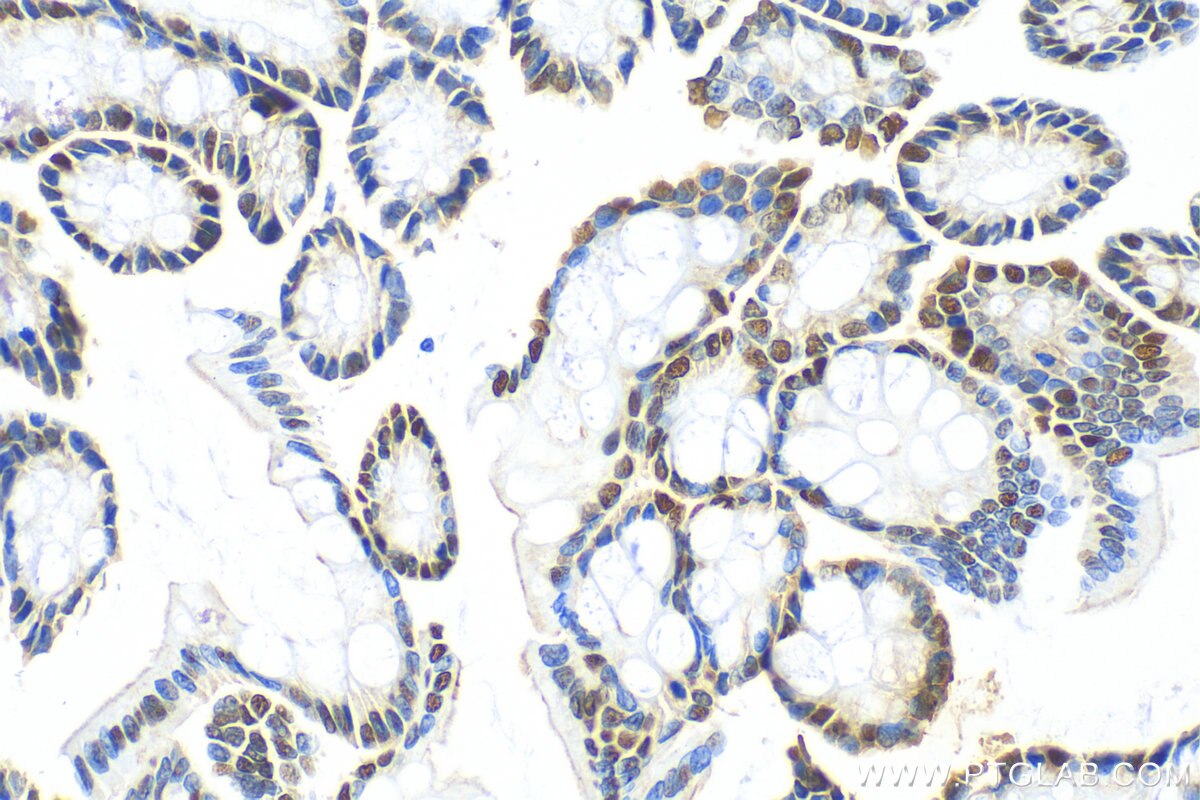 Immunohistochemistry (IHC) staining of rat colon tissue using CDX2 Recombinant antibody (82659-1-RR)