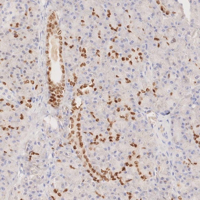 IHC staining of human pancreas using 82659-1-RR Immunohistochemistry (IHC) staining of human pancreas tissue using CDX2 Recombinant monoclonal antibody (82659-1-RR)