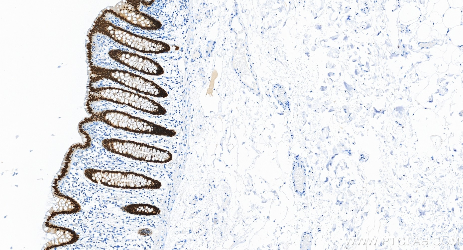 Immunohistochemistry (IHC) staining of human colon tissue using CDX2 Recombinant monoclonal antibody (82663-1-RR)