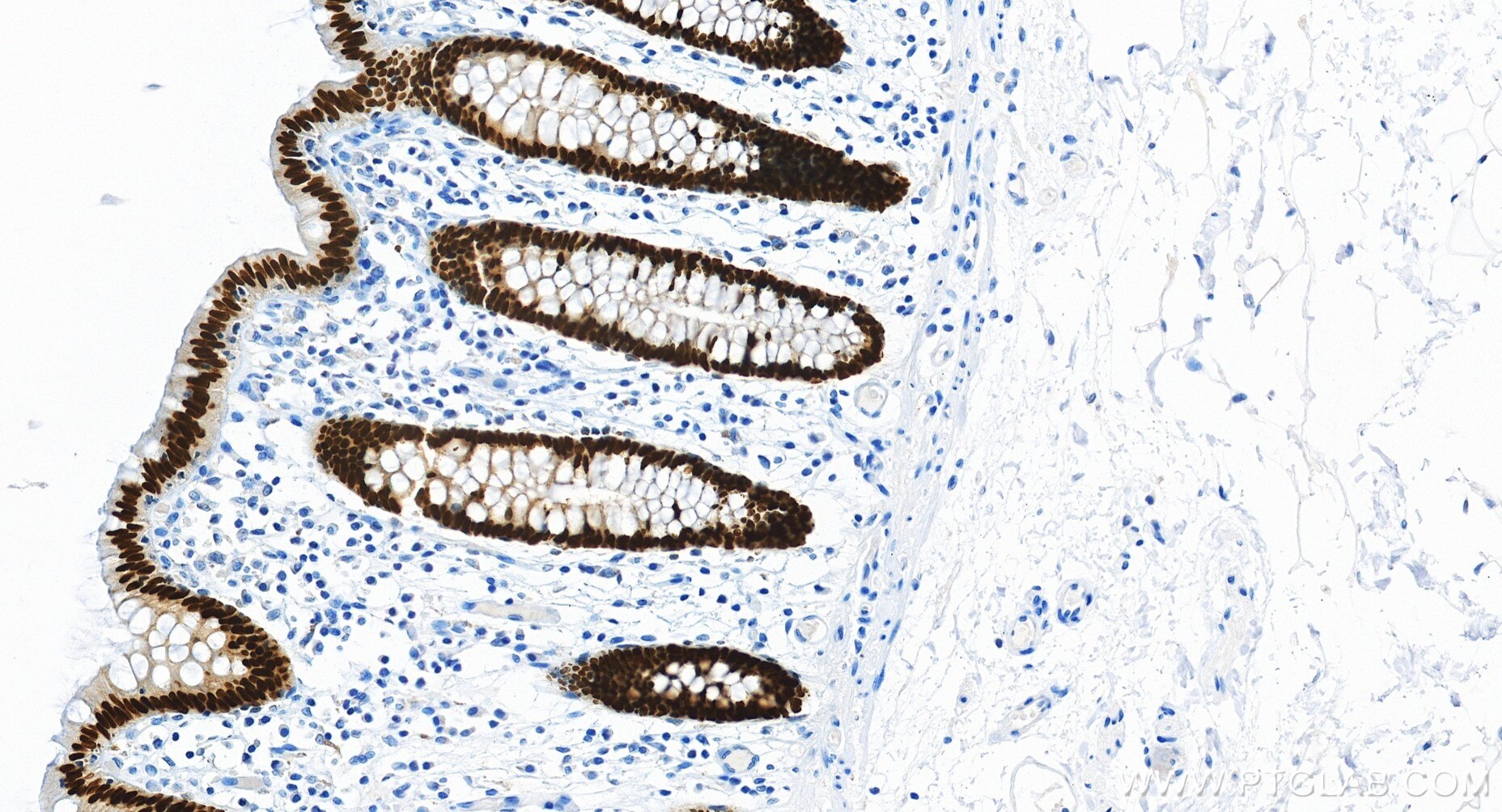 Immunohistochemistry (IHC) staining of human colon tissue using CDX2 Recombinant monoclonal antibody (82663-1-RR)