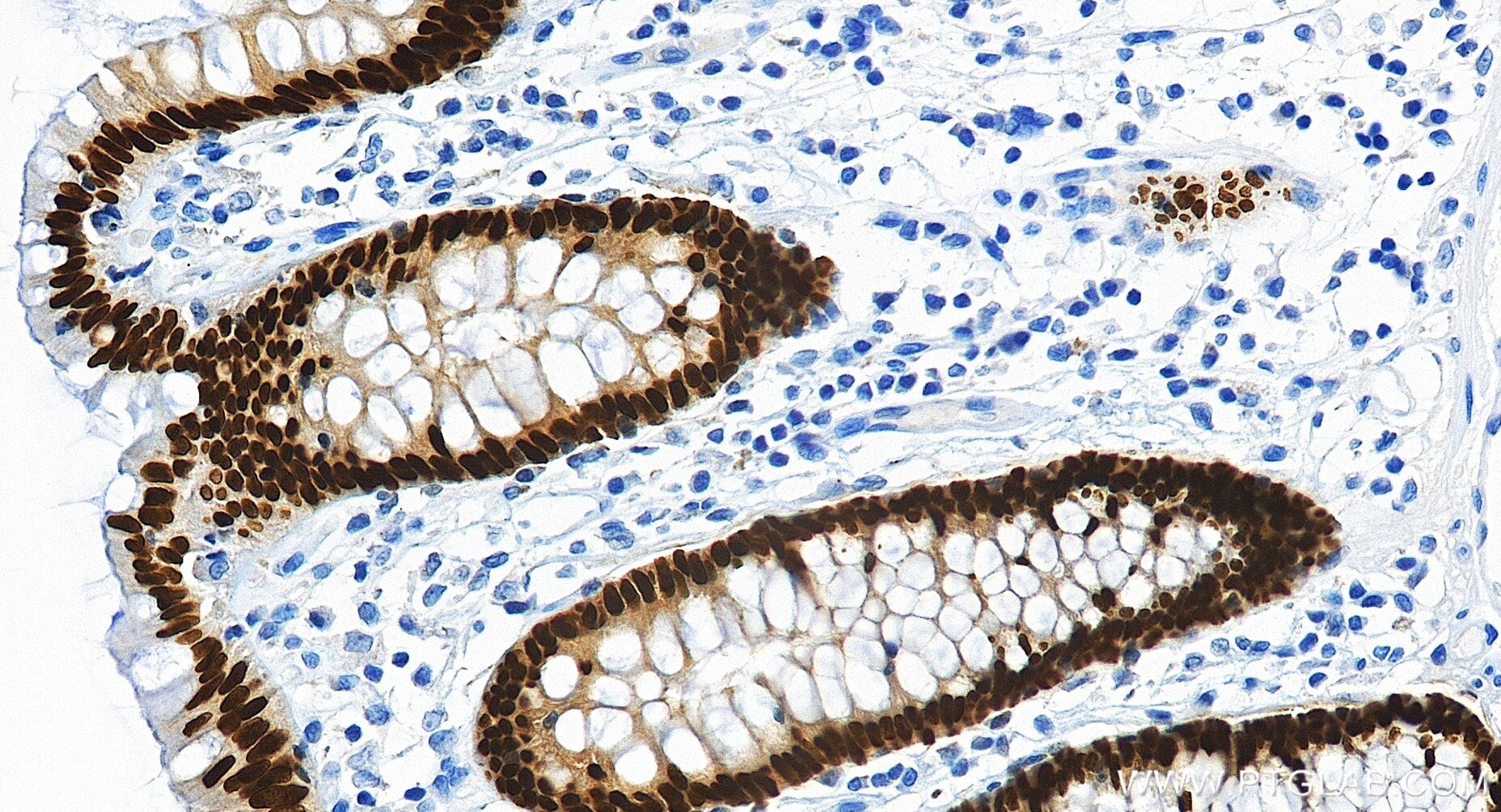 Immunohistochemistry (IHC) staining of human colon tissue using CDX2 Recombinant monoclonal antibody (82663-1-RR)