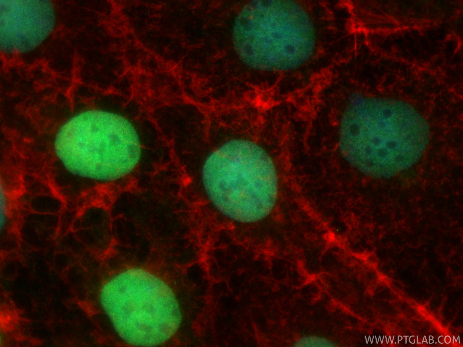 Immunofluorescence (IF) / fluorescent staining of Caco-2 cells using CDX2 Recombinant monoclonal antibody (82663-1-RR)