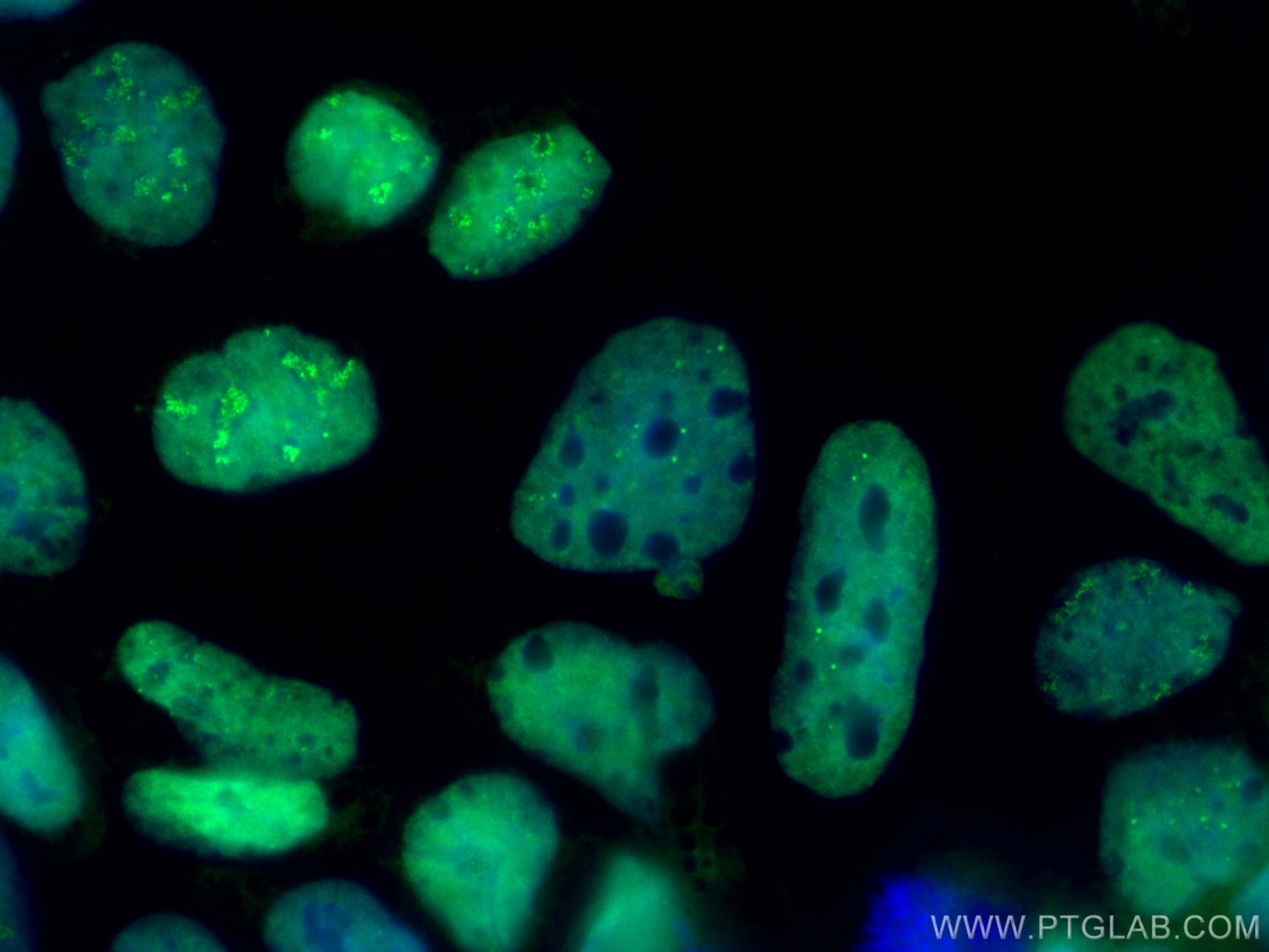 Immunofluorescence (IF) / fluorescent staining of Caco-2 cells using CoraLite® Plus 488-conjugated CDX2 Recombinant ant (CL488-82659)