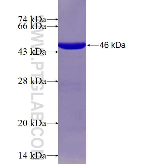 CDX2 fusion protein Ag17310 SDS-PAGE