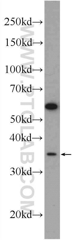 Western Blot (WB) analysis of mouse thymus tissue using CDX4 Polyclonal antibody (22943-1-AP)