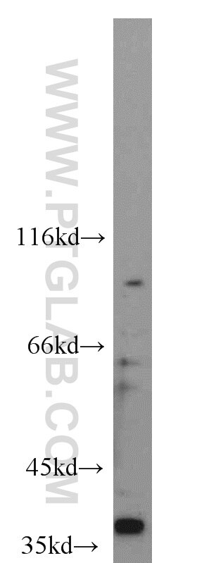 Western Blot (WB) analysis of SKOV-3 cells using CDX4 Polyclonal antibody (22943-1-AP)