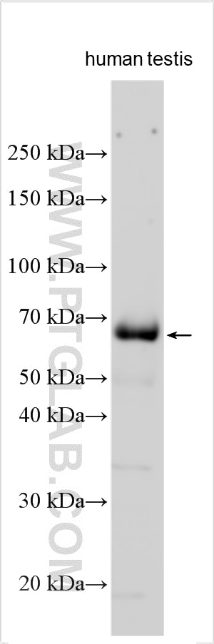 Western Blot (WB) analysis of various lysates using CDY1B Polyclonal antibody (33231-1-AP)