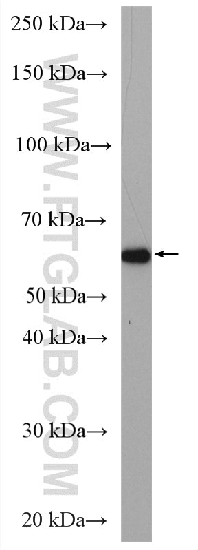 Western Blot (WB) analysis of PC-3 cells using CDYL Polyclonal antibody (17763-1-AP)