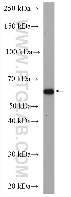 WB analysis of PC-3 using 17763-1-AP