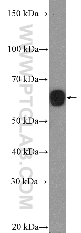 Western Blot (WB) analysis of MCF-7 cells using CDYL Polyclonal antibody (17763-1-AP)