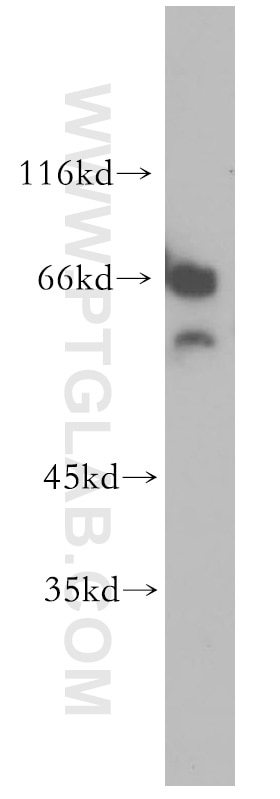 Western Blot (WB) analysis of mouse testis tissue using CDYL Polyclonal antibody (17763-1-AP)
