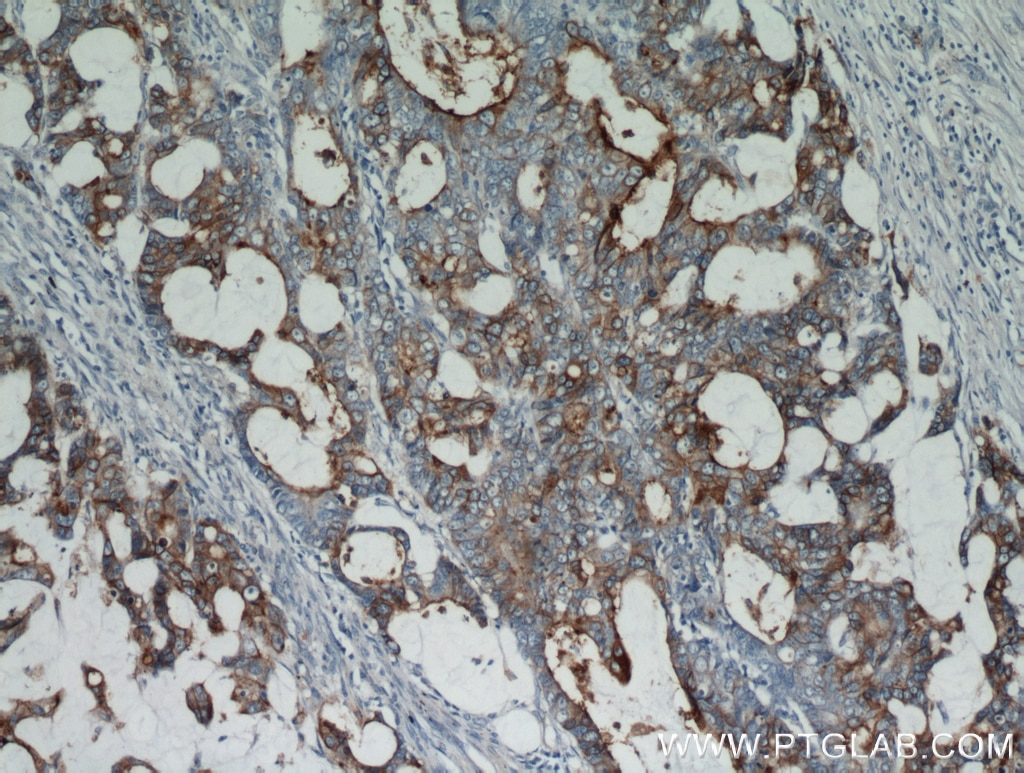 CEA Polyclonal antibody